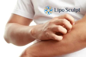 Best Actinic Keratoses Removal 4 prevent your actinic keratoses Gosport getting worse - call our team today!