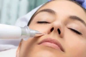 Best Actinic Keratoses Removal 3 Actinic keratoses Gosport solutions - book in today!