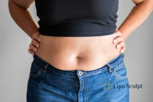Bidding Farewell to Muffin Tops with Aqualyx Fat Injections 2 Do you wish you could reduce your muffin top Gosport With Aqualy fat dissolving injections you can!