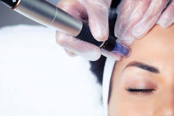 Explaining Total Skin Tightening Treatment and What to Expect 2 What Skin Concerns Can Total Skin Tightening Treatment Help With Gosport?
