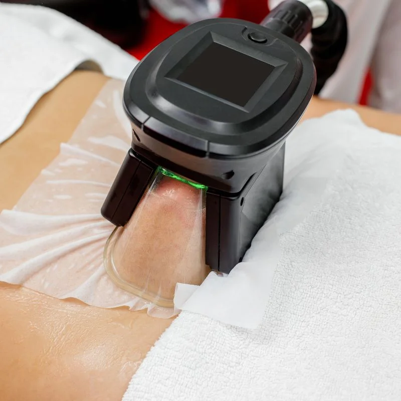 Fat Freezing treatment Gosport